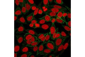 Immunofluorescence (IF) image for anti-Catenin (Cadherin-Associated Protein), beta 1, 88kDa (CTNNB1) antibody (ABIN6939211)