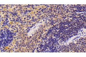 Immunohistochemistry (IHC) image for anti-Nuclear Factor kappa B (NFkB) (AA 352-439) antibody (ABIN7434143)