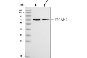 Western blot analysis of VMAT2/SLC18A2 using anti-VMAT2/SLC18A2 antibody (ABIN7599459).