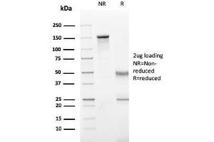 SDS-PAGE Analysis Purified Perforin-1 Monospecific Mouse Monoclonal Antibody (PRF1/2470). (Perforin 1 抗体  (AA 413-552))