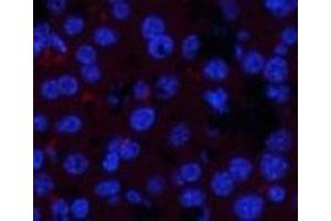 Immunofluorescence analysis of Mouse liver tissue with Phospho-JAK1 (Tyr1022) Polyclonal Antibody at dilution of 1:200 (JAK1 抗体  (pTyr1022))