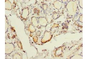 Immunohistochemistry of paraffin-embedded human thyroid tissue using ABIN7153260 at dilution of 1:100 (FYCO1 抗体  (AA 2-255))
