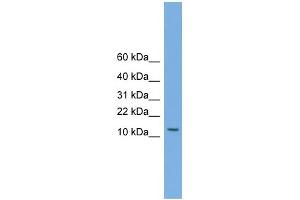 WB Suggested Anti-MAGEA5 Antibody Titration:  0. (MAGEA5 抗体  (N-Term))