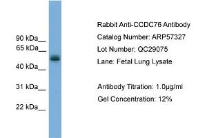 WB Suggested Anti-CCDC76  Antibody Titration: 0. (CCDC76 抗体  (N-Term))