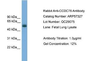 WB Suggested Anti-CCDC76  Antibody Titration: 0.