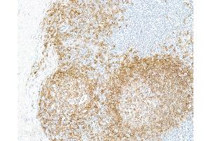 Immunohistochemistry (IHC) image for anti-B-cell antigen receptor complex-associated protein alpha chain (CD79A) (AA 33-143) antibody (ABIN7453962)