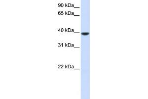 WB Suggested Anti-AGPAT5 Antibody Titration:  0. (AGPAT5 抗体  (N-Term))