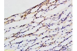 Immunohistochemistry (Paraffin-embedded Sections) (IHC (p)) image for anti-Defensin, beta 1 (DEFB1) (AA 33-68) antibody (ABIN738591)