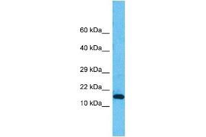 Host:  Rabbit  Target Name:  PNKD  Sample Type:  HepG2 Whole Cell lysates  Antibody Dilution:  1. (PNKD 抗体  (N-Term))