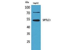 Western Blotting (WB) image for anti-serine Palmitoyltransferase, Long Chain Base Subunit 1 (SPTLC1) (C-Term) antibody (ABIN3187765) (SPTLC1 抗体  (C-Term))