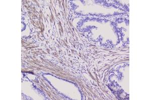 IHC analysis of NSE using anti-NSE antibody (ABIN6719549). (ENO2/NSE 抗体)