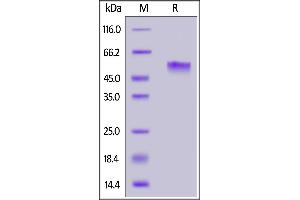 SDS-PAGE (SDS) image for Poliovirus Receptor-Related Immunoglobulin Domain Containing (PVRIG) (AA 41-171) (Active) protein (mFc Tag) (ABIN7013635)