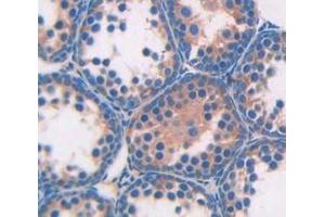 IHC-P analysis of Kidney tissue, with DAB staining. (Angiotensin I Converting Enzyme 1 抗体  (AA 334-409))