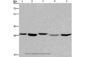 Western blot analysis of 293T, MCF-7 and PC3 cell, human fetal liver tissue and Hela cell, using ECHS1 Polyclonal Antibody at dilution of 1:300 (ECHS1 抗体)