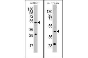 Image no. 1 for anti-Plasminogen Activator, Urokinase (PLAU) (AA 68-98), (N-Term) antibody (ABIN2853629) (PLAU 抗体  (N-Term))