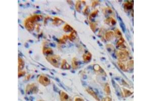 Immunohistochemistry (IHC) image for anti-Enolase 1 (ENO1) (AA 78-241) antibody (ABIN1860013)