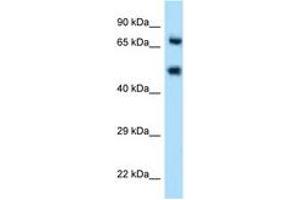 Image no. 1 for anti-Selectin E (SELE) (AA 81-130) antibody (ABIN6746548) (Selectin E/CD62e 抗体  (AA 81-130))