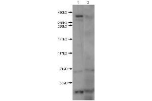 Western Blot of Rabbit Anti-Huntington antibody. (Huntingtin 抗体  (N-Term))