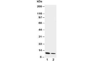 Western blot testing of Resistin antibody and Lane 1:  recombinant mouse protein 10ng;  2: 5ng (Resistin 抗体  (C-Term))