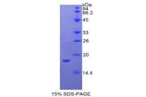 SDS-PAGE analysis of Rabbit Interleukin 1 alpha Protein.