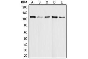 Western blot analysis of DAXX expression in HeLa (A), Molt4 (B), Ramos (C), K562 (D), HEK293T (E) whole cell lysates. (DAXX 抗体  (Center))