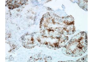 Immunohistochemistry analysis using Mouse Anti-Hsp60 Monoclonal Antibody, Clone LK-1 . (HSPD1 抗体  (APC))