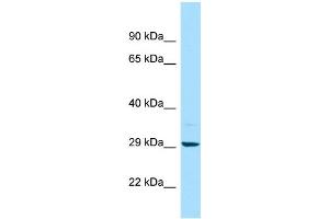 WB Suggested Anti-MAPRE2 Antibody Titration: 1. (MAPRE2 抗体  (C-Term))