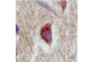 Immunohistochemistry with Brain, cortex tissue at an antibody concentration of 2. (SLC18A1 抗体  (Middle Region))