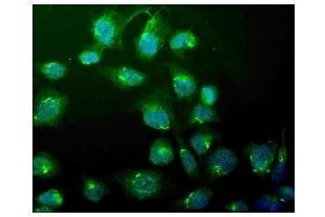 IF analysis of WEE1 using anti-WEE1 antibody (ABIN6719614). (WEE1 抗体)