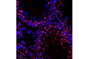Immunofluorescence of paraffin embedded rat testis using HOXC9 (ABIN7074251) at dilution of 1:650 (300x lens)