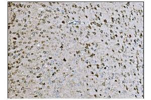 IHC analysis of LRP1B using anti-LRP1B antibody (ABIN7601521). (LRP1B 抗体  (AA 3704-4547))