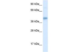 WB Suggested Anti-SEC14L2 Antibody Titration: 0. (SEC14L2 抗体  (Middle Region))