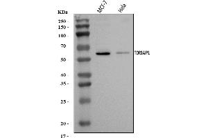Western blot analysis of TOR1AIP1 using anti-TOR1AIP1 antibody (ABIN7599399).