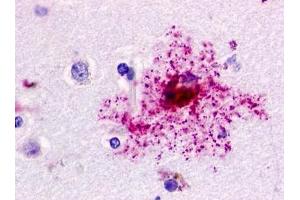 Immunohistochemical staining of Brain (Astrocyte) using anti- GPR84 antibody ABIN122097 (GPR84 抗体)