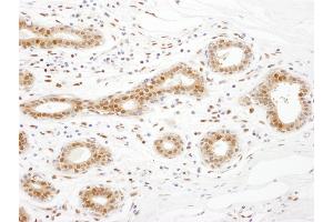 Immunohistochemistry (IHC) image for anti-Translin-Associated Factor X (TSNAX) (AA 240-290) antibody (ABIN7453532) (TSNAX 抗体  (AA 240-290))
