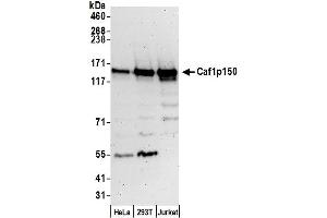 Western Blotting (WB) image for anti-Chromatin Assembly Factor 1, Subunit A (p150) (CHAF1A) (AA 500-550) antibody (ABIN7453671)