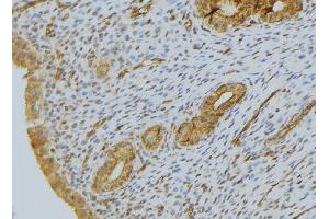 ABIN6276519 at 1/100 staining Human uterus tissue by IHC-P. (CYR61 抗体  (Internal Region))