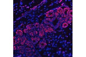 IF analysis of RPL32 using anti-RPL32 antibody (ABIN7602916). (RPL32 抗体  (C-Term))