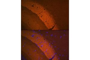 Immunofluorescence analysis of mouse brain using mGluR2 Rabbit mAb (ABIN1682570, ABIN3017965, ABIN3017966 and ABIN7101551) at dilution of 1:100 (40x lens). (GRM2 抗体)