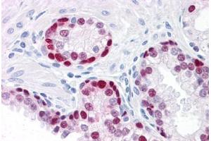 Human Prostate: Formalin-Fixed, Paraffin-Embedded (FFPE) (SOX9 抗体  (AA 400-510))