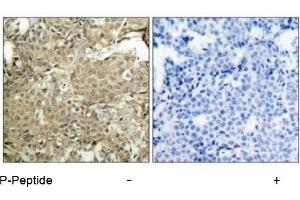 Image no. 1 for anti-Cofilin 1 (CFL1) (pSer3) antibody (ABIN196855) (Cofilin 抗体  (pSer3))