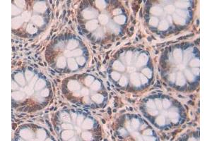 DAB staining on IHC-P; Samples: Human Intestine Tissue (RNASET2 抗体  (AA 25-256))