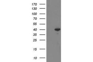 Western Blotting (WB) image for anti-Reticulon 4 Interacting Protein 1 (RTN4IP1) antibody (ABIN1500771) (RTN4IP1 抗体)