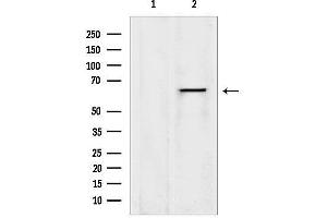 anti-Eukaryotic Translation Initiation Factor 2D (EIF2D) (Internal Region) antibody