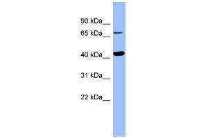 WB Suggested Anti-HPD Antibody Titration:  0. (HPD 抗体  (Middle Region))
