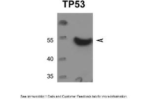 WB Suggested Anti-TP53 Antibody  Titration: 0. (p53 抗体  (C-Term))