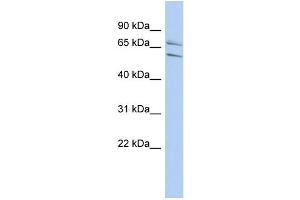 WB Suggested Anti-PHF21A Antibody Titration:  0. (PHF21A 抗体  (N-Term))