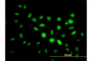 Immunofluorescence of monoclonal antibody to PHF1 on HeLa cell. (PHF1 抗体  (AA 2-100))