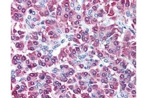 Image no. 3 for anti-Cbl proto-oncogene C (CBLC) (AA 444-458) antibody (ABIN401316) (CBLC 抗体  (AA 444-458))