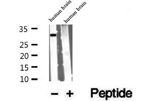 Western blot analysis of extracts of human brain tissue, using VDAC3 antibody. (VDAC3 抗体  (N-Term))